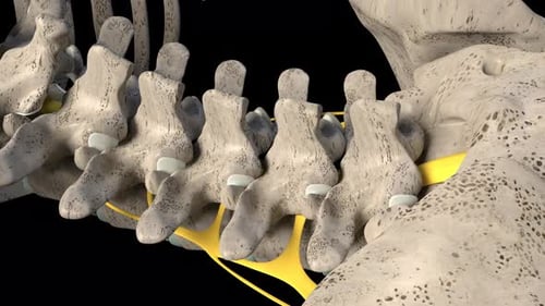3D Medical Animation: Lumbar Spine Disc Herniation and Nerve Compression