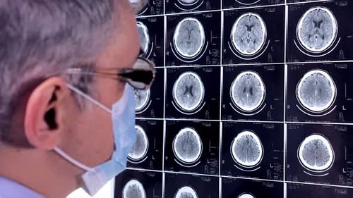 Arzt Neurologe sucht ein MRT