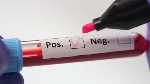 Coronavirus Blood Sample Test Marked Positive