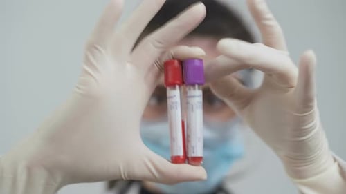 Medical Professional Holds Blood Sample Vials