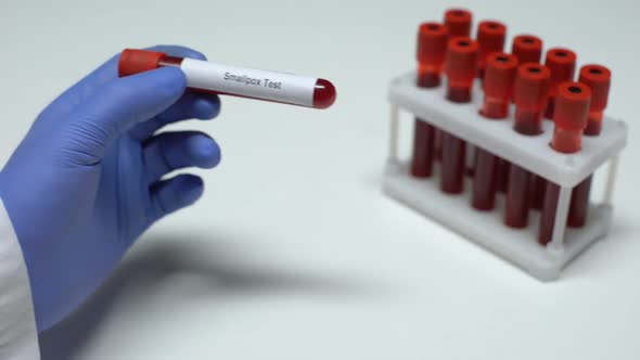 Smallpox Test, Doctor Showing Blood Sample in Tube, Lab Research ...