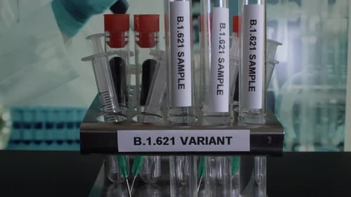 B.1.621 Proben des Reagenzglases werden aus dem Gestell entnommen. Abgesperrt, Schuss wird eingerichtet