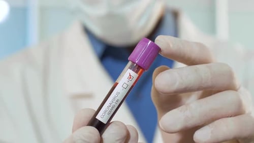 Medical Professional Holds Coronavirus Positive Blood Test Tube