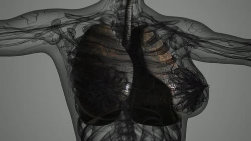 3D Animated Medical Scan of Diseased Human Lungs