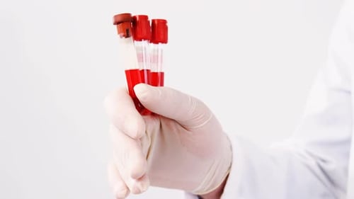 Gloved Hand Holding Blood Samples