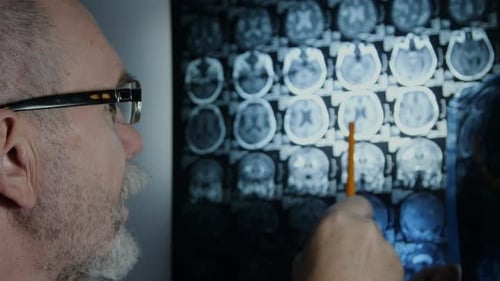 Senior doctor reviewing brain MRI