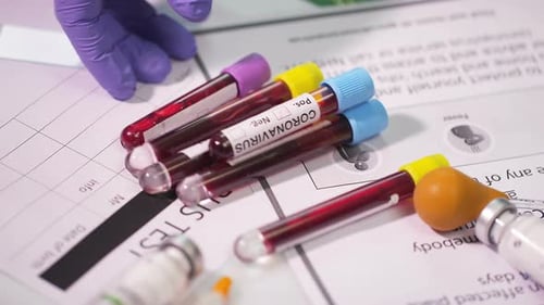 Coronavirus-Test