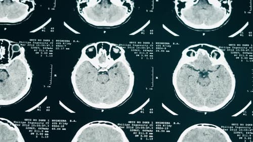 Close Up of Brain Scan Film