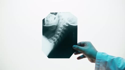 Hand Holding Medical X-Ray of Spine and Skull