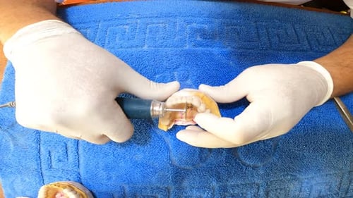 Dentist Works on Plaster Teeth Model with Tool
