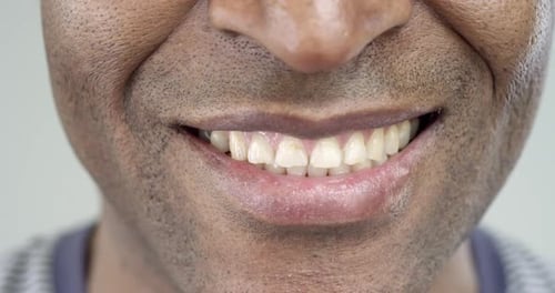 Close Up Of Adult Smiling Mouth And Teeth