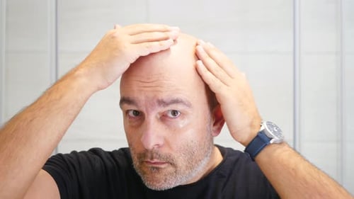 Bald Man Scared Of Losing Hair