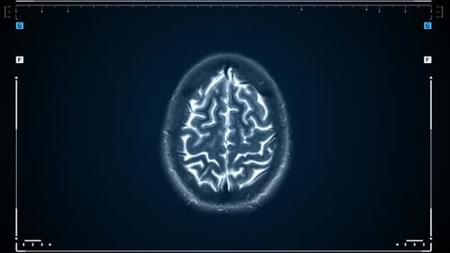 Brain MRI Scan