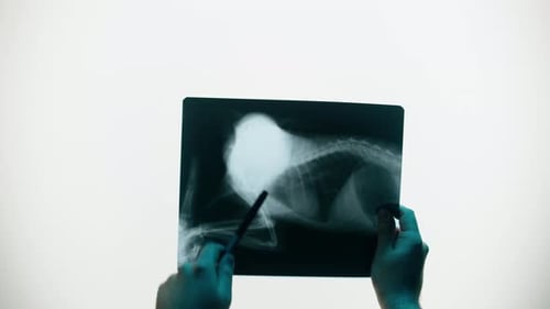 Hands Pointing to an X-Ray Image of Torso