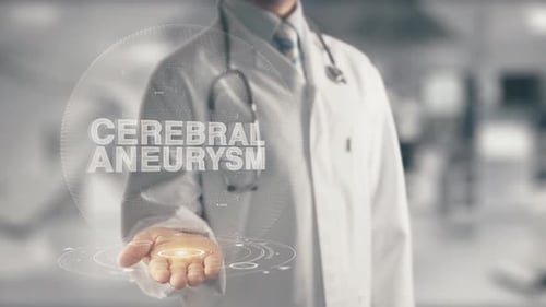 Doctor Holding in Hand Cerebral Aneurysm