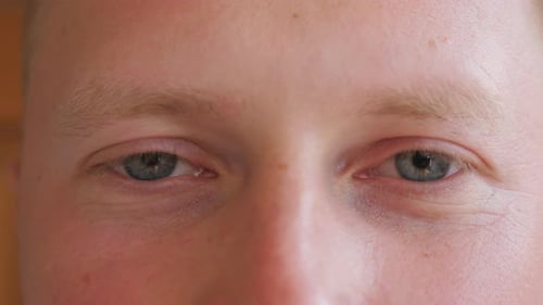 Nahaufnahme Blue Eyes of Guy, der mit einem müden Anblick starrt und blinkt. Porträt eines männlichen Gesichtes