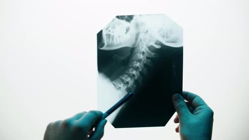Hands Pointing to Head and Neck X-Ray