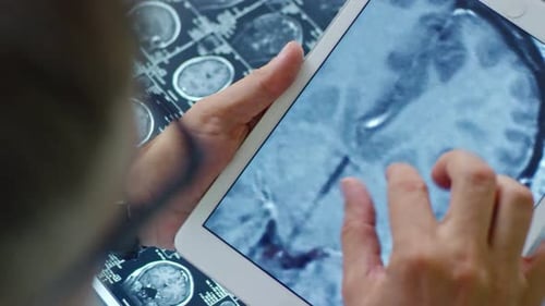 Doctor Looking at CT Scan on Tablet