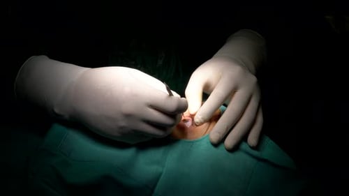 Eye Surgery