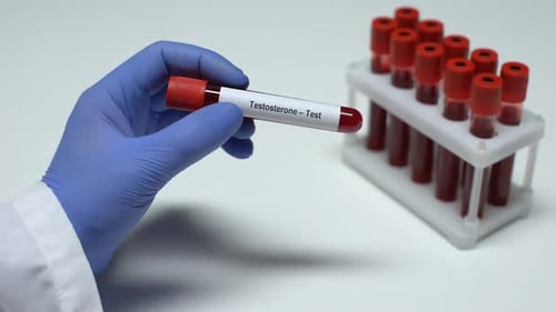 Testosterone Doctor Showing Blood Sample in Tube Lab Research Health Checkup