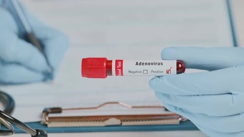 Positive Adenovirus Blood Test Result in Hospital