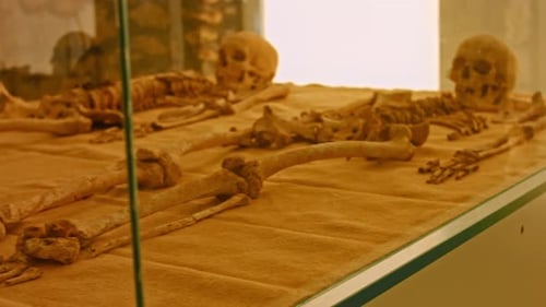 Menschlicher Schädel in einer Vitrine
