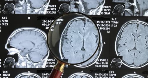 Magnifying Glass Examining Medical Brain Scans