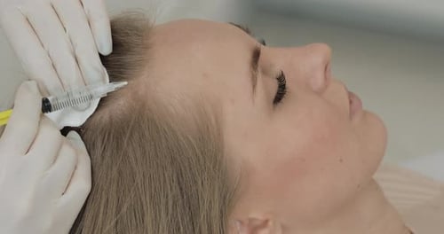 Young Attractive Woman Receives Mesotherapy for Hair