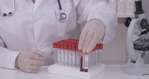 Lab Worker Arranges Blood Samples for Analysis