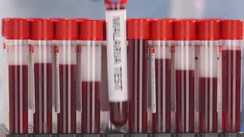 Installation d'un tube de laboratoire avec un test de