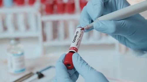 Lab Worker Marks Positive COVID Blood Test