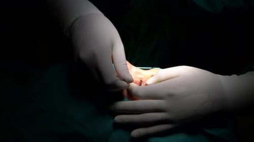 Eye Surgery With Laser
