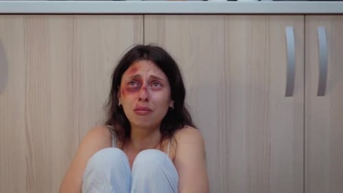 Distressed Woman with Injuries Crying, Abuse Concept