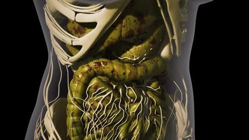 Pulsating Diseased Human Digestive Organs 3D Animation