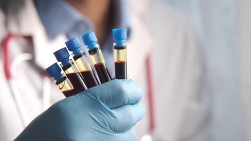 Close Up of Blood Vials Held in Gloved Hand