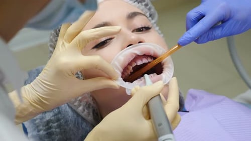 Oral Hygiene and Prophylactic Cleaning