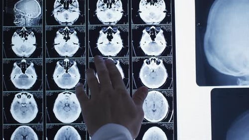 Hand Points to Brain Scans in Hospital Setting