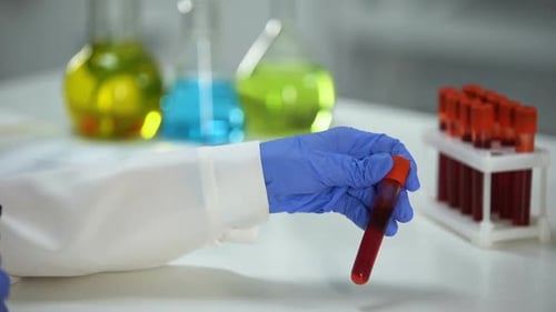 Gloved Hand Labels Blood Sample Test Tube