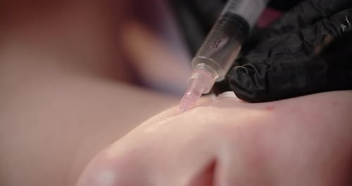 Cosmetologist Does Injections to the Woman's Face Botox and Hyaluronic Acid Rejuvenating Beauty