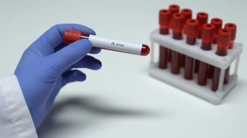 Test Tube with Blood Sample Labeled JE Virus