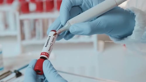 Marking Hepatitis B Test Tube in Bright Lab