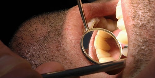 Male Patient Receiving Dental Examination Close Up