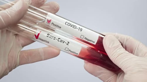 COVID-19 Test Vials with Blood Samples