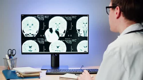 Arzt untersucht Röntgenbild auf Computermonitor