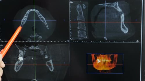 Dentist Pointing at Teeth Scanning on Xray Picture and Explaining Diagnostics and Treatment Plan