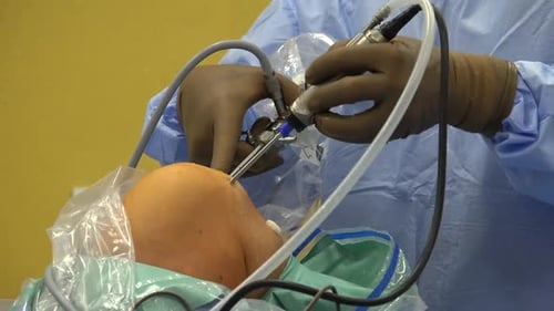 Arthroscopic Knee Surgery in Hospital Operating Room