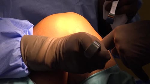 Surgeon Operating on a Knee in Operating Room