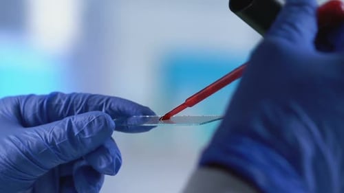 Blood Sample Analysis with Pipette and Microscope