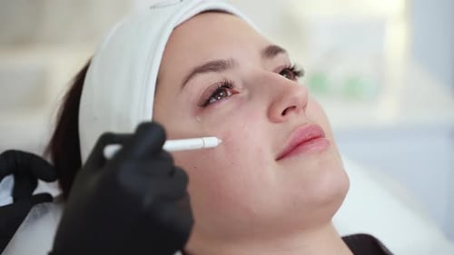 Beautician Marking Face for Filler Injection