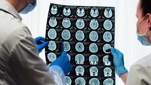 Medical Professionals Analyze Brain Scans in Hospital